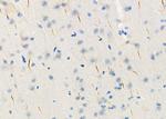 BAMBI Antibody in Immunohistochemistry (Paraffin) (IHC (P))