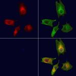 BBS10 Polyclonal Antibody