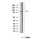 BBS10 Antibody in Western Blot (WB)