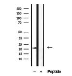 ARL6 Antibody in Western Blot (WB)