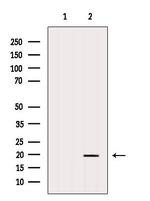 ARL6 Polyclonal Antibody