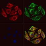 SH3KBP1 Polyclonal Antibody