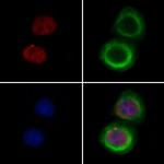 CNOT10 Polyclonal Antibody