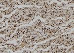 CNOT10 Antibody in Immunohistochemistry (Paraffin) (IHC (P))