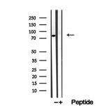 CNOT10 Antibody in Western Blot (WB)