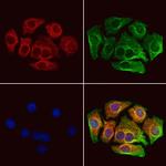 CAT1 Antibody in Immunocytochemistry (ICC/IF)