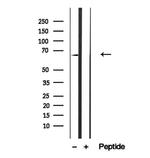 CAT1 Antibody in Western Blot (WB)