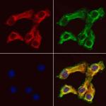 CRLS1 Polyclonal Antibody