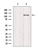 DAAM1 Polyclonal Antibody