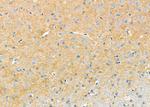 Drebrin Antibody in Immunohistochemistry (Paraffin) (IHC (P))