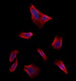 FBXO22 Polyclonal Antibody