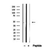 FBXO22 Antibody in Western Blot (WB)