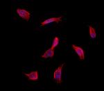 INSIG1 Polyclonal Antibody