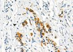 ITLN1 Antibody in Immunohistochemistry (Paraffin) (IHC (P))