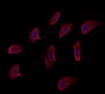 eIF2d Polyclonal Antibody