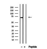 eIF2d Antibody in Western Blot (WB)