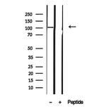 MTHFD1L Antibody in Western Blot (WB)