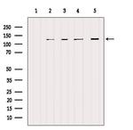 NCKAP1 Antibody in Western Blot (WB)