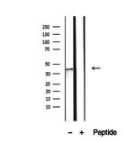 NSDHL Antibody in Western Blot (WB)