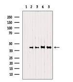 NSDHL Polyclonal Antibody