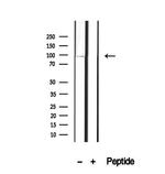 OPHN1 Antibody in Western Blot (WB)