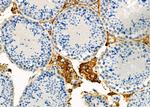 P4HA2 Polyclonal Antibody