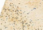 P4HA2 Antibody in Immunohistochemistry (Paraffin) (IHC (P))