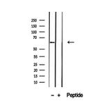 P4HA2 Antibody in Western Blot (WB)