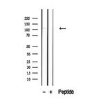 PACS2 Antibody in Western Blot (WB)