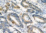 PCCA Polyclonal Antibody