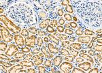 PCCA Antibody in Immunohistochemistry (Paraffin) (IHC (P))