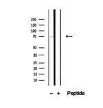 PCCA Antibody in Western Blot (WB)