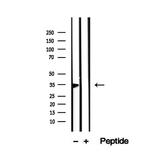 PHF11 Antibody in Western Blot (WB)