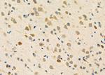 PHF19 Antibody in Immunohistochemistry (Paraffin) (IHC (P))