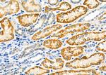 PIK3IP1 Antibody in Immunohistochemistry (Paraffin) (IHC (P))