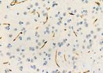 PIK3IP1 Antibody in Immunohistochemistry (Paraffin) (IHC (P))