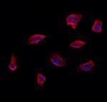 RAB14 Polyclonal Antibody