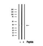 ROGDI Antibody in Western Blot (WB)