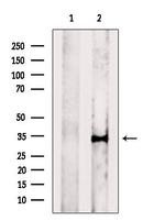 ROGDI Polyclonal Antibody