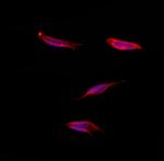 SGCG Polyclonal Antibody