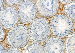 SPAG4L Polyclonal Antibody