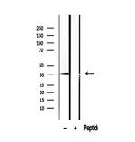 SUGT1 Antibody in Western Blot (WB)