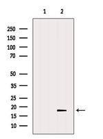 TMEM70 Polyclonal Antibody