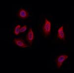 UFD1L Polyclonal Antibody