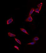 VDAC3 Polyclonal Antibody