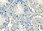VDAC3 Antibody in Immunohistochemistry (Paraffin) (IHC (P))