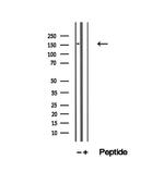 ZFYVE16 Antibody in Western Blot (WB)