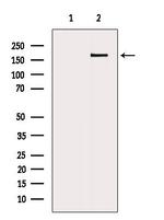 ZFYVE16 Antibody in Western Blot (WB)