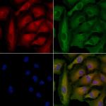 ABCB4 Polyclonal Antibody