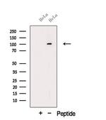 ORP6 Polyclonal Antibody